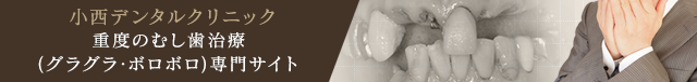 重度の虫歯治療専用サイト